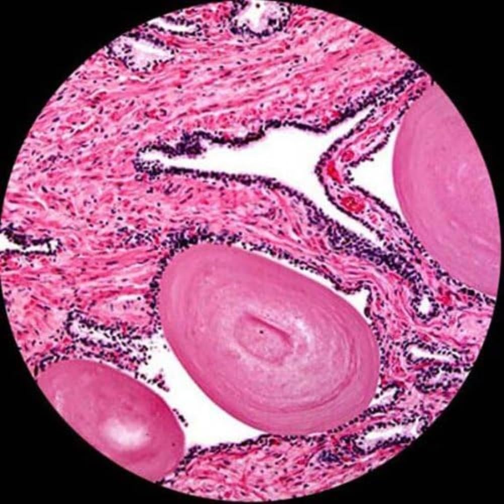 AmScope T690C-PL Trinocular Compound Microscope, 40X-2500X Magnification, WH10x and WH25x Super-Widefield Eyepieces, Infinity Plan Achromatic Objectives, Brightfield, Kohler Condenser, Double-Layer Mechanical Stage