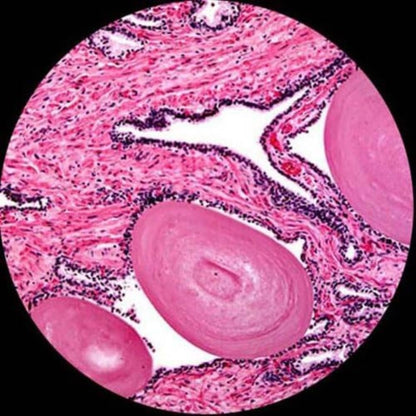 AmScope T690C-PL Trinocular Compound Microscope, 40X-2500X Magnification, WH10x and WH25x Super-Widefield Eyepieces, Infinity Plan Achromatic Objectives, Brightfield, Kohler Condenser, Double-Layer Mechanical Stage