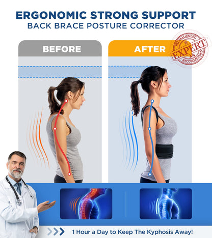 FILLOVE Posture Corrector for Women and Men with Magnetic Therapy Back Support, Strong Traction & Fully Adjustable Upper Back Brace Back Straightener for Neck, Clavicle, Spine and Shoulder Pain Relief