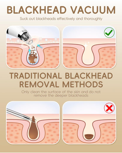 Facial Pore Blackhead Remover Vacuum - Fore Cleaner and Blackhead Extractor with 3 Adjustable Suction Levels - 5 Probes - Pore Vacuum Kit for Women&Men (White)