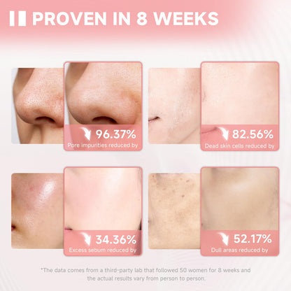 Turmeric Kojic Acid Facial Cleanser, Brightening Foaming Face Wash with Soft Massage Heads, Kojic Acid Cleanser Exfoliating, Turmeric Cleansing for Dark Spots 4.23 oz
