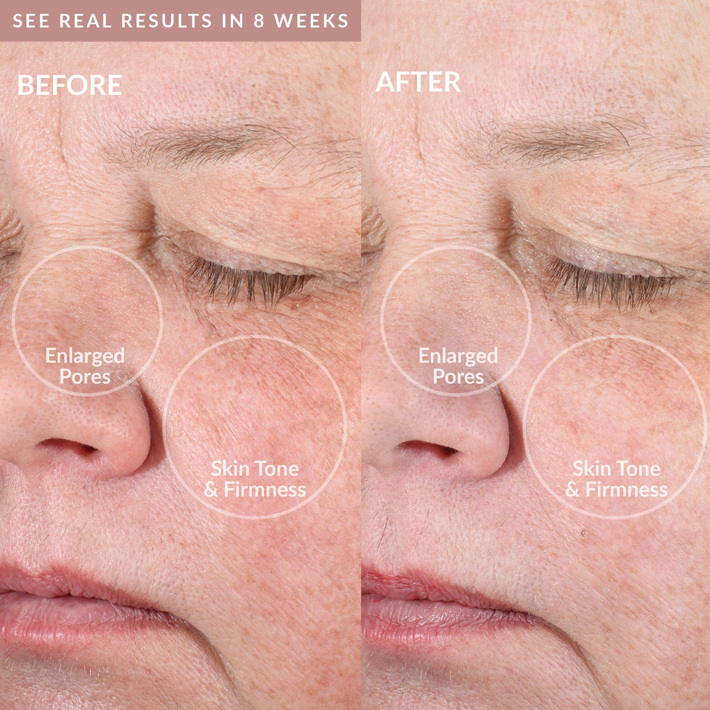 PMD Beauty Clean Pro OB - Smart Facial Cleansing Device